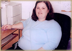 Photo of Patient Before Weight Loss Program